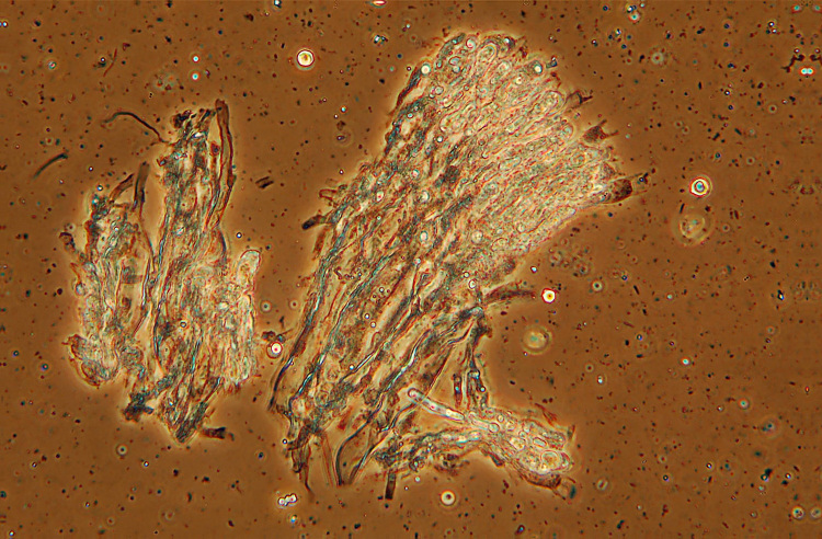 Crostina su Larice da det.-foto 2717(Vesiculomyces citrinus)